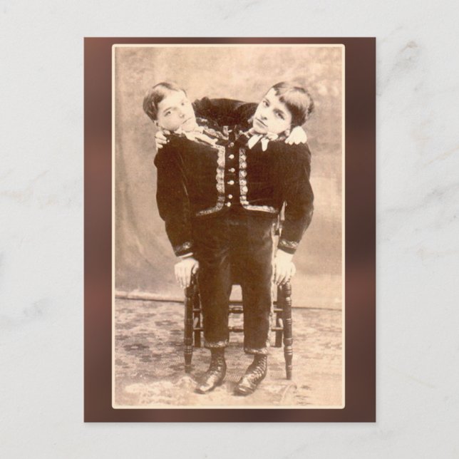 Conjoined Twins Vintage Cards and Postcards (Front)