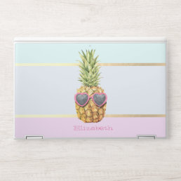 Cool Pineapple Tropical HP Laptop Skin
