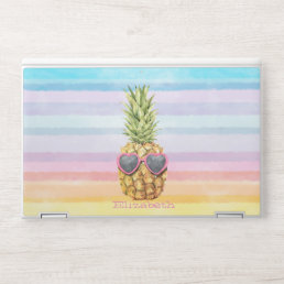 Cool Pineapple, Watercolor Stripes  HP Laptop Skin