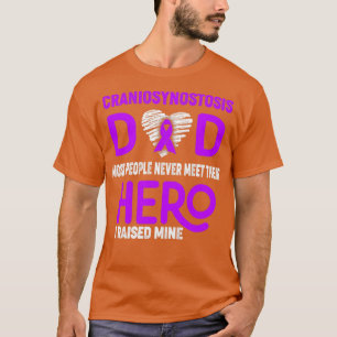Craniosynostosis Dad Most People Never Meet Their  T-Shirt