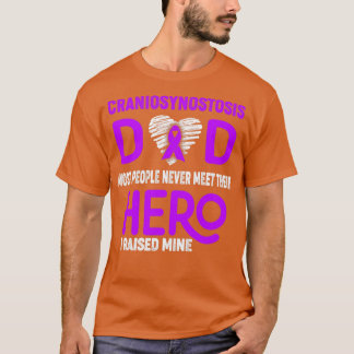 Craniosynostosis Dad Most People Never Meet Their  T-Shirt