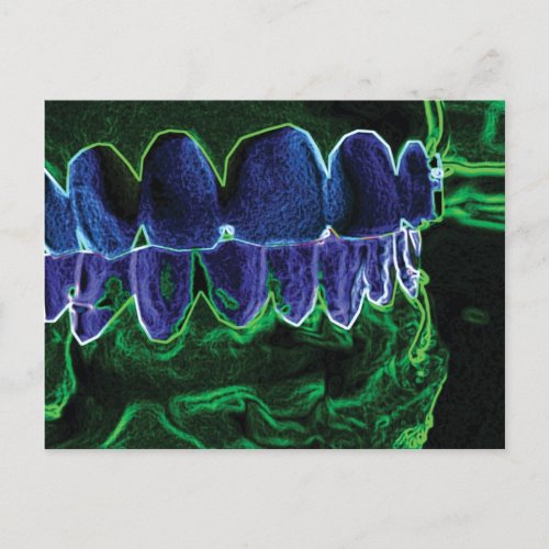 Crazy Teeth Model Dentist Orthodontist Card