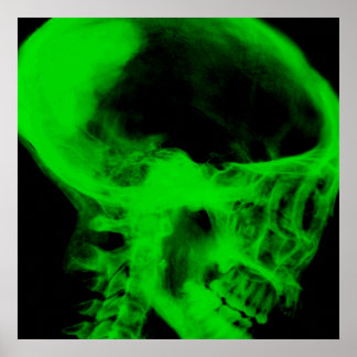 Creepy X-Ray Skull (Black & Green) Poster