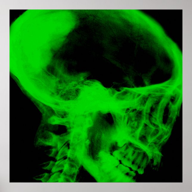 Creepy X-Ray Skull (Black & Green) Poster (Front)