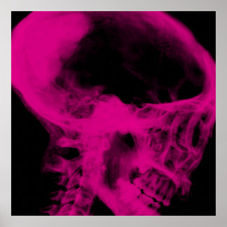 Creepy X-Ray Skull (Black & Pink) Poster