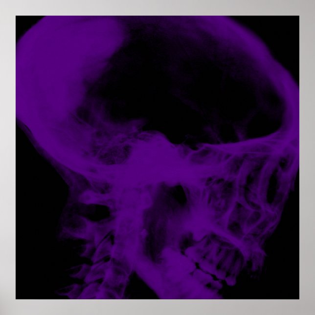 Creepy X-Ray Skull (Black & Purple) Poster (Front)