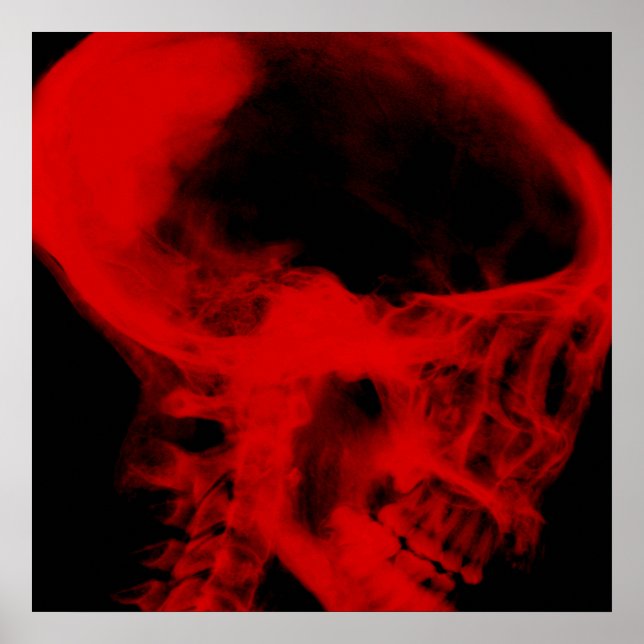 Creepy X-Ray Skull (Black & Red) Poster (Front)