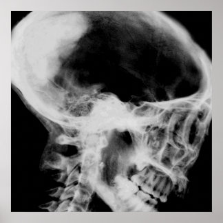Creepy X-Ray Skull (Black & White) Poster