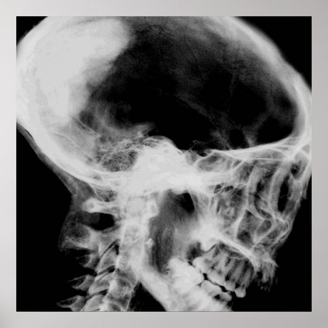 Creepy X-Ray Skull (Black & White) Poster (Front)