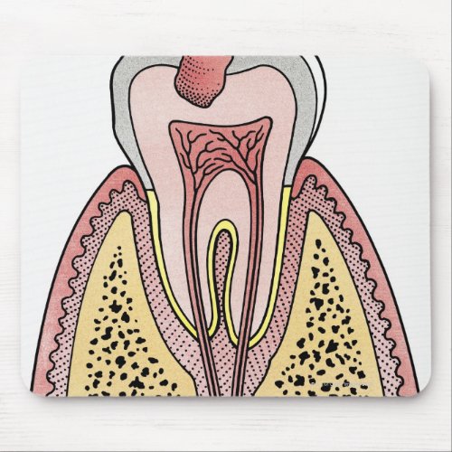 Cross section illustration showing tooth decay mouse pad