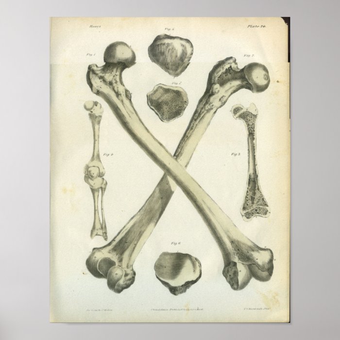 Crossed Femur Bones Anatomy Art Poster