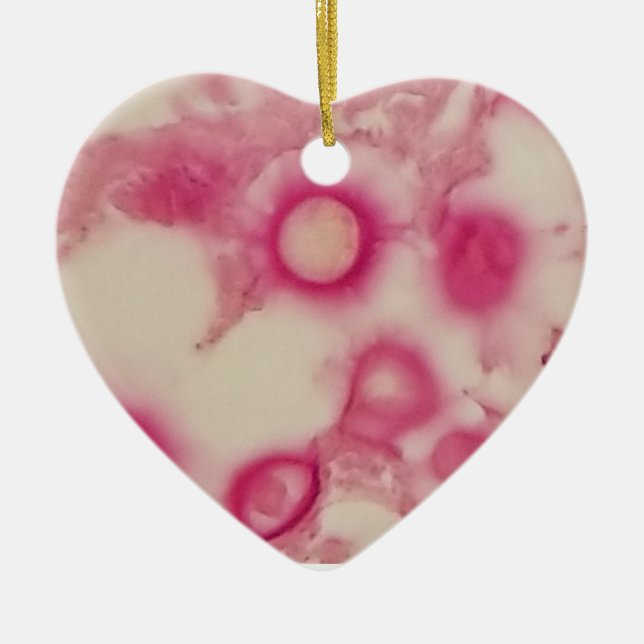 Cryptococcal Ornament (Front)