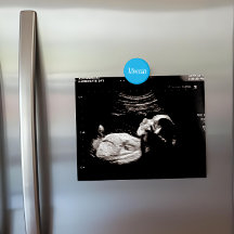 Custom Azure Blue Name Ultrasound Display Fridge