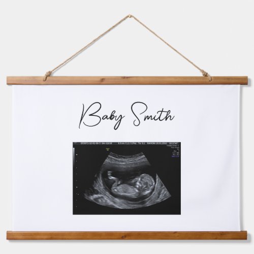 Custom Baby Sonogram Ultrasound Wood Topped Hanging Tapestry