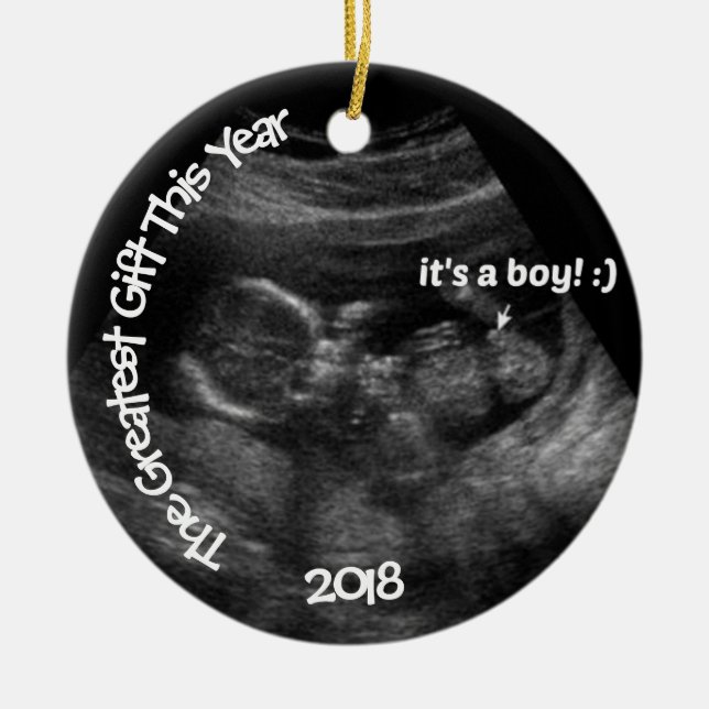 Custom EASY Ultrasound Template Ceramic Ornament (Front)