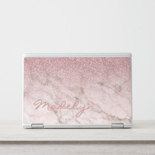Custom Rose Gold Glitter Blush Pink Marble Pattern HP Laptop Skin