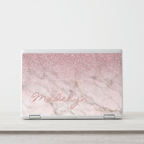 Custom Rose Gold Glitter Blush Pink Marble Pattern HP Laptop Skin