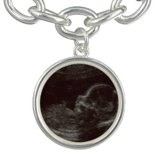 Custom Ultrasound Photo Charm Bracelet