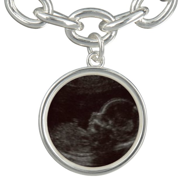 Custom Ultrasound Photo Charm Bracelet (Design)