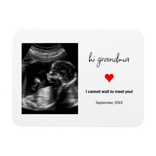 Custom Ultrasound Photo Gift For Grandma Grandpa Magnet