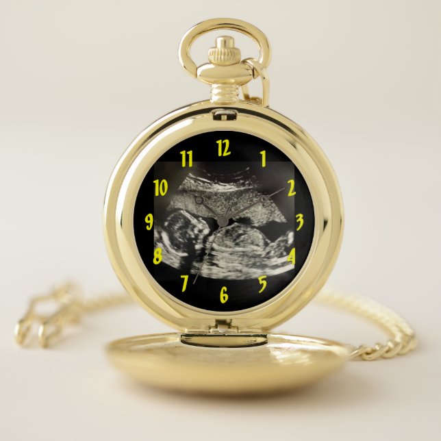 Custom Ultrasound Pocket Watch (Inside)