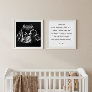  Custom Ultrasound Poster Set, Love Letter  Wall Art Sets