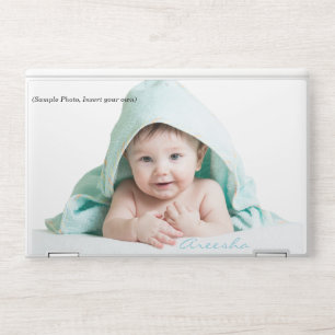 Custom Your Cute Kid Photo HP Laptop Skin