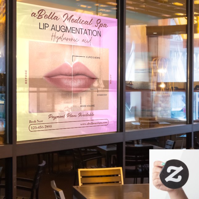 Customize Med Spa Lip Augmentation Hyaluronic Fill Window Cling (Restaurant Window)