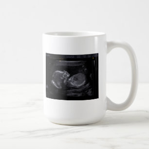 Customized Ultrasound Mug