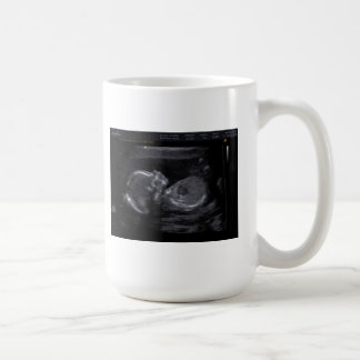 Customized Ultrasound Mug