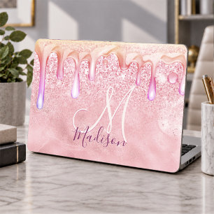 Cute ombre rose gold faux glitter drips monogram HP laptop skin