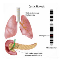 Cystic fibrosis Poster