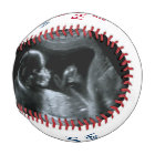 Dad to Be Sonogram Photo First Fathers Day