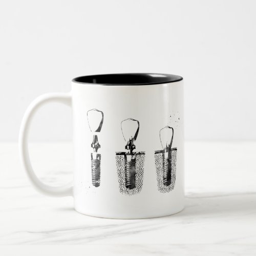 Dental implant procedure Two_Tone coffee mug