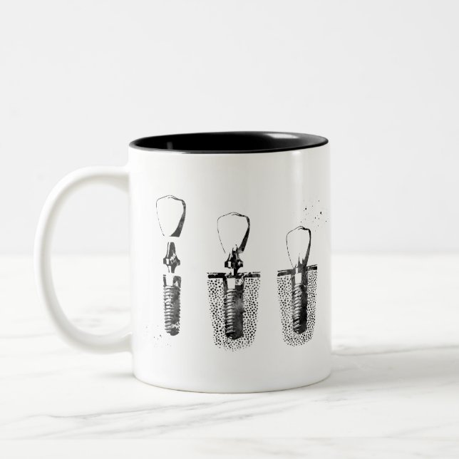 Dental implant procedure Two-Tone coffee mug (Left)