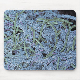 Dental plaque, coloured scanning electron mouse pad