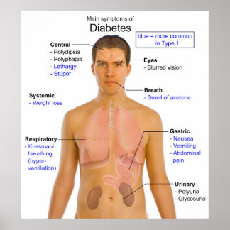 Diagram of the Main Symptoms of Diabetes in Humans Poster