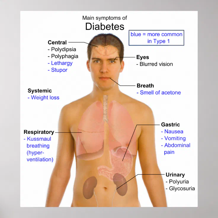 diabetes mellitus type 1 signs and symptoms