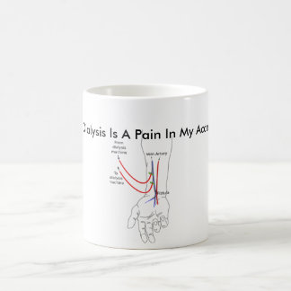 Dialysis Is A Pain In My Access Coffee Mug