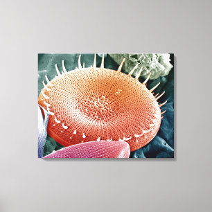 Diatom, a unicellular algae. canvas print
