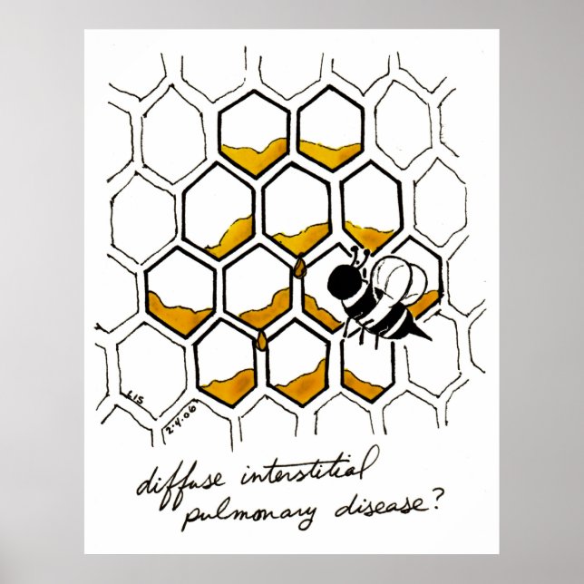 Diffuse Interstitial Pulmonary Disease Poster (Front)