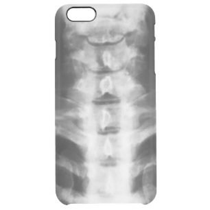 Digital Cervical X-Ray Art Clear Case
