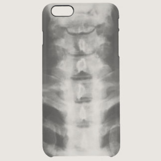 Digital Cervical X-Ray Art Clear Case