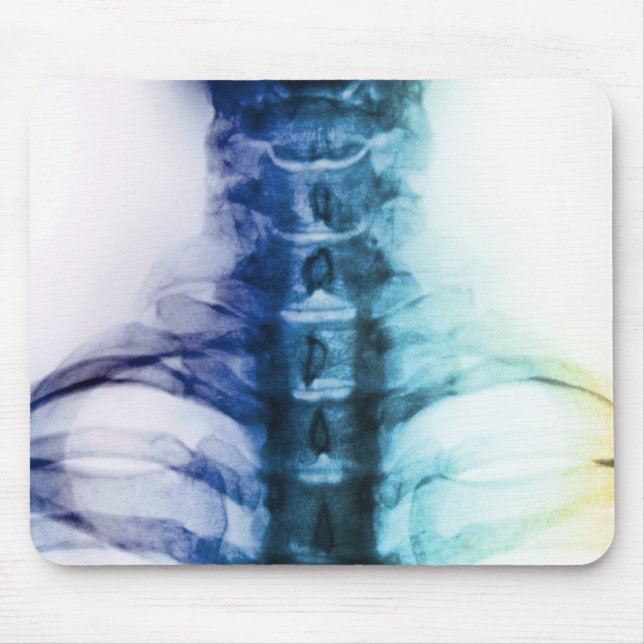 Digital Cervical X-Ray Art Mouse Pad (Front)