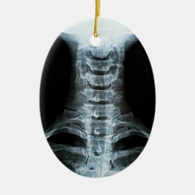 Digital X-Ray Art (Custom Back Text) Ceramic Ornament (Front)
