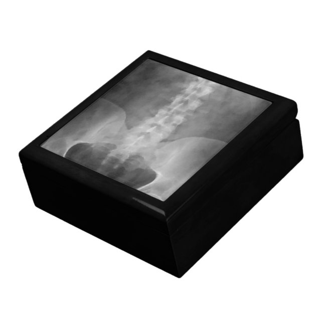 Digital X-Ray Art Gift Box (Side)