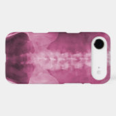 Digital X-Ray Art iPhone 4/4s Case (Back (Horizontal))