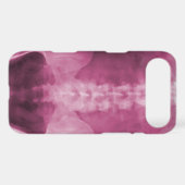 Digital X-Ray Art iPhone 4/4s Case (Back (Horizontal))