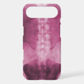 Digital X-Ray Art iPhone 4/4s Case (Back)