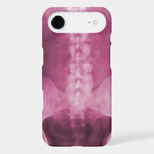 Digital X-Ray Art iPhone 4/4s Case (Back)